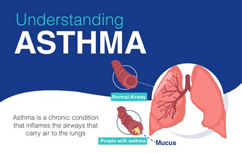 What Causes Asthma To Come Back